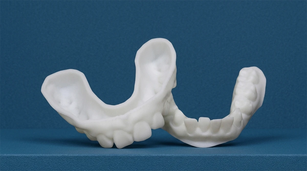 Display of 3D printed maxillary dental model made with NextShapes Precision Stone Resin, showcasing high precision and clear anatomical details