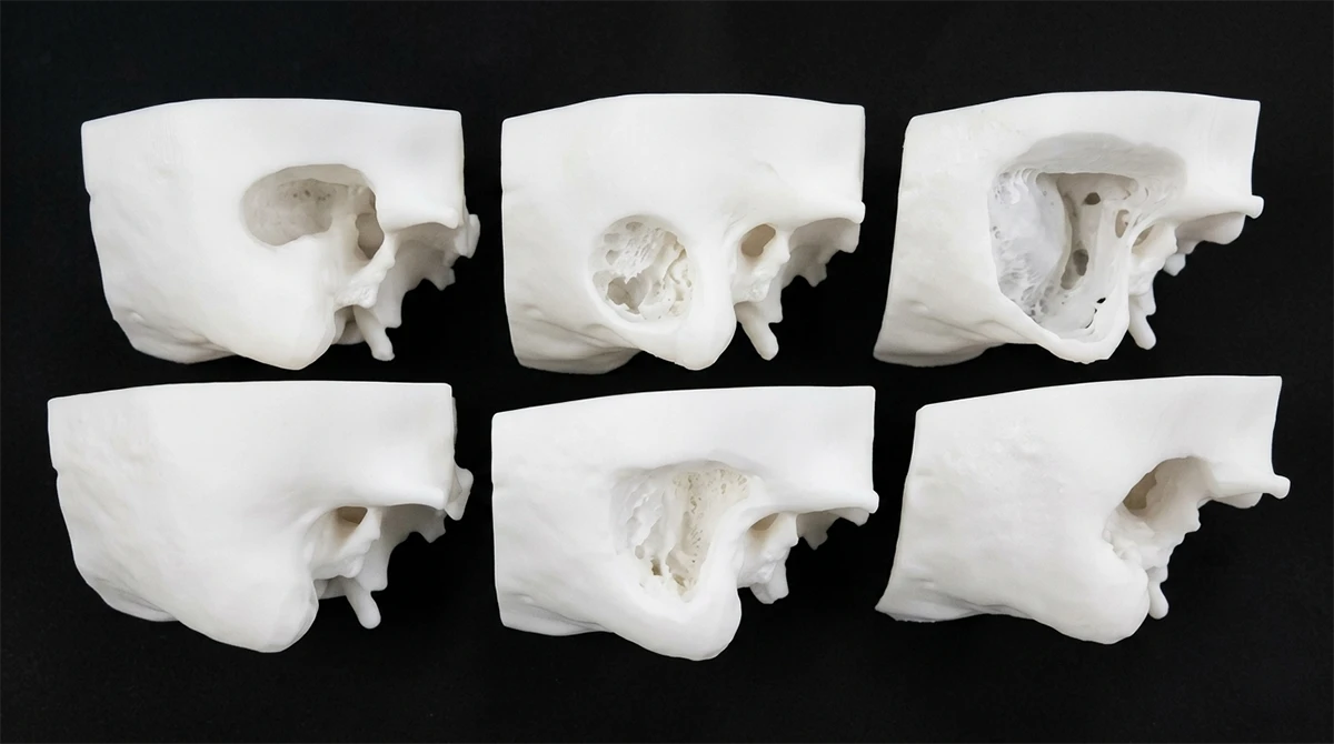 Array display of 3D printed temporal bone anatomical models made with NextShapes Precision Stone Resin, demonstrating intricate internal structure reproduction